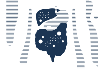 Xpert® GI Panel: rýchla diagnostika gastrointestinálnych patogénov na platforme GeneXpert